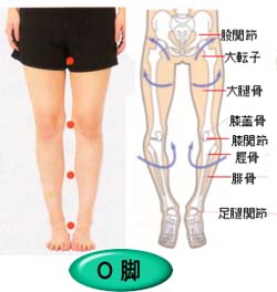 O脚矯正 アットホーム